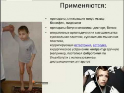 ДЦП и БАДы NSP О,Шершун ДЦП и БАДы NSP О,Шершун