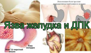 Как лечить больной желудок в домашних условиях Как лечить больной желудок в домашних условиях